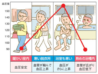 暖かい室内：血圧安定 寒い脱衣所：血管が縮んで血圧上昇 浴室も寒い：血圧がさらに上昇 熱めの浴槽内：血管が広がり血圧低下